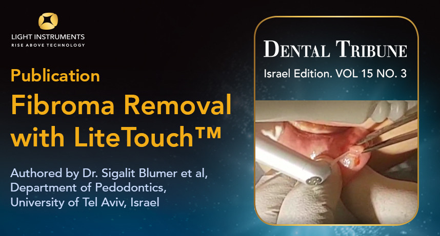 Fibroma removal with LiteTouch™ Er:YAG laser