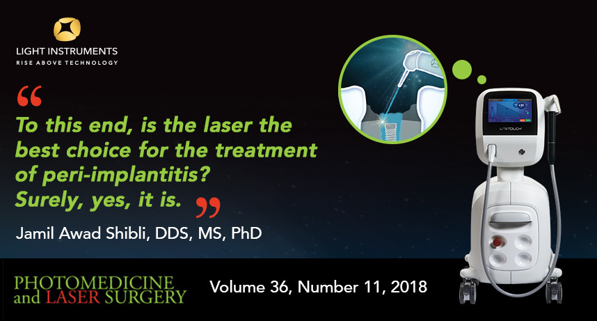 Is Laser the Best Choice for the Treatment of Peri-Implantitis?