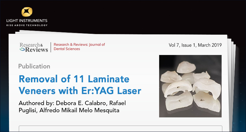 New Article: Removal of 11 Laminate Veneers with Er:YAG Laser