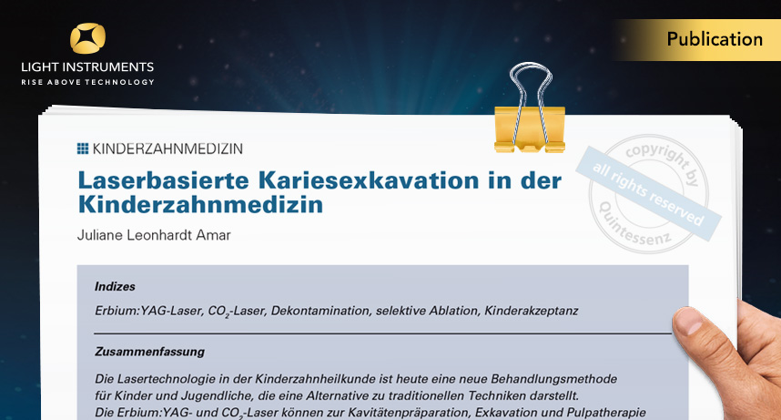 German Article – Laser-based caries excavation in pediatric dentistry (Laserbasierte kariesexkavation in der kinderzahnmedizin)