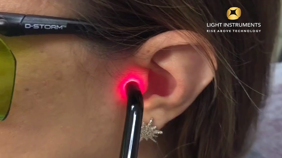 <strong>TMJ Treatment with the D-Storm™ Diode Laser</strong>
