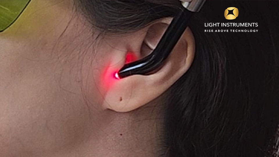 <strong>Oral trismus Treatment with the D-Storm™ Diode Laser</strong>